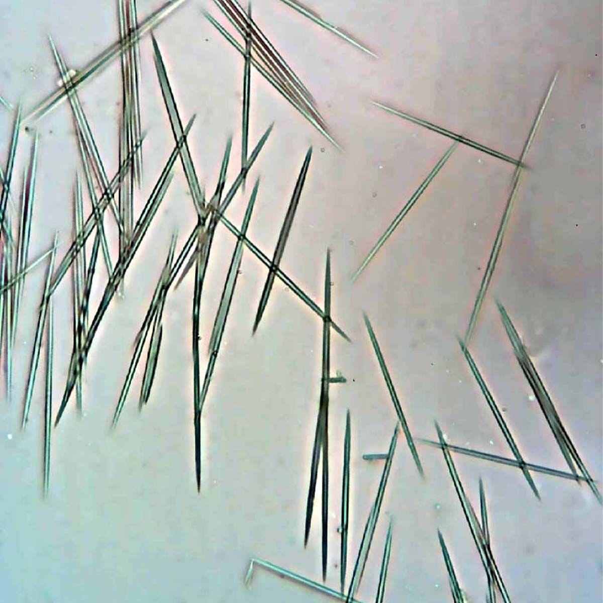 Taro-Calcium-Oxalates.jpg